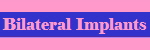Bilateral Implants